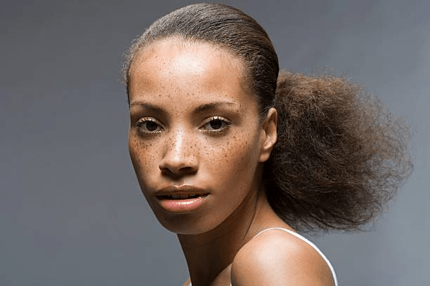 Pigmentation 101: The Types & How To Treat Them